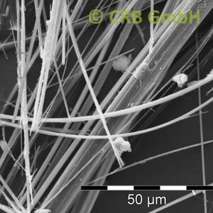 SEM image actinolite | © © CRB Analyse Service GmbH